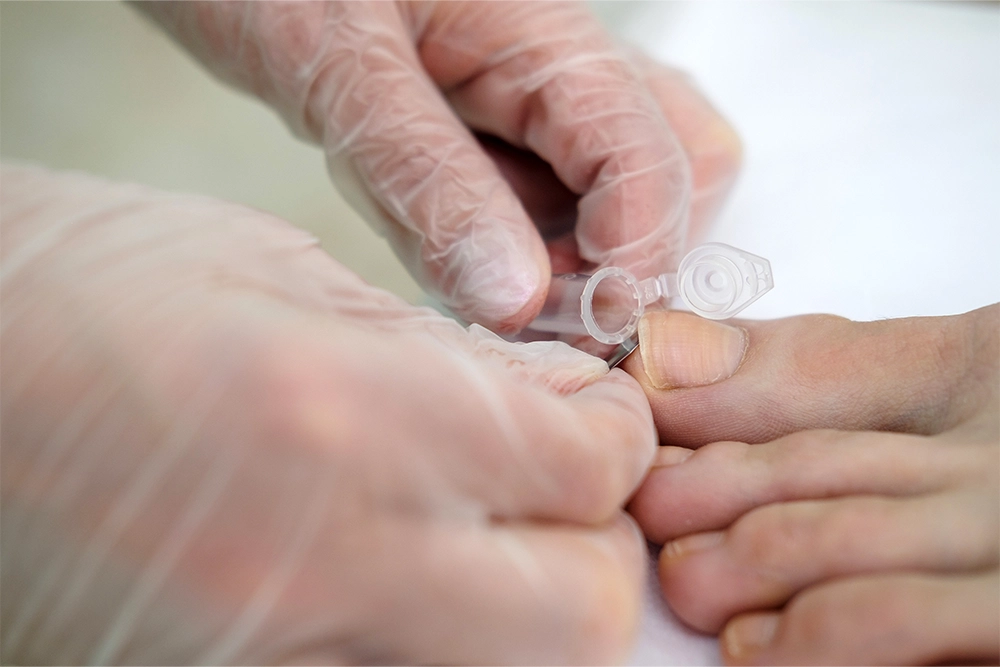 Biopsies Of Skin And Nail